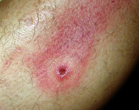 Flaatbid-450