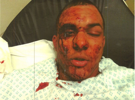 Francesco-2-Hounye-injuries